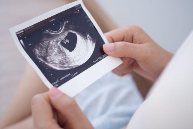What Can Ultrasounds in Pregnancy Tell Me About My Baby’s Health? What Can Ultrasounds in Pregnancy Tell Me About My Baby's Health?
