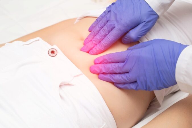 Fibroids: What Every Woman Should Know